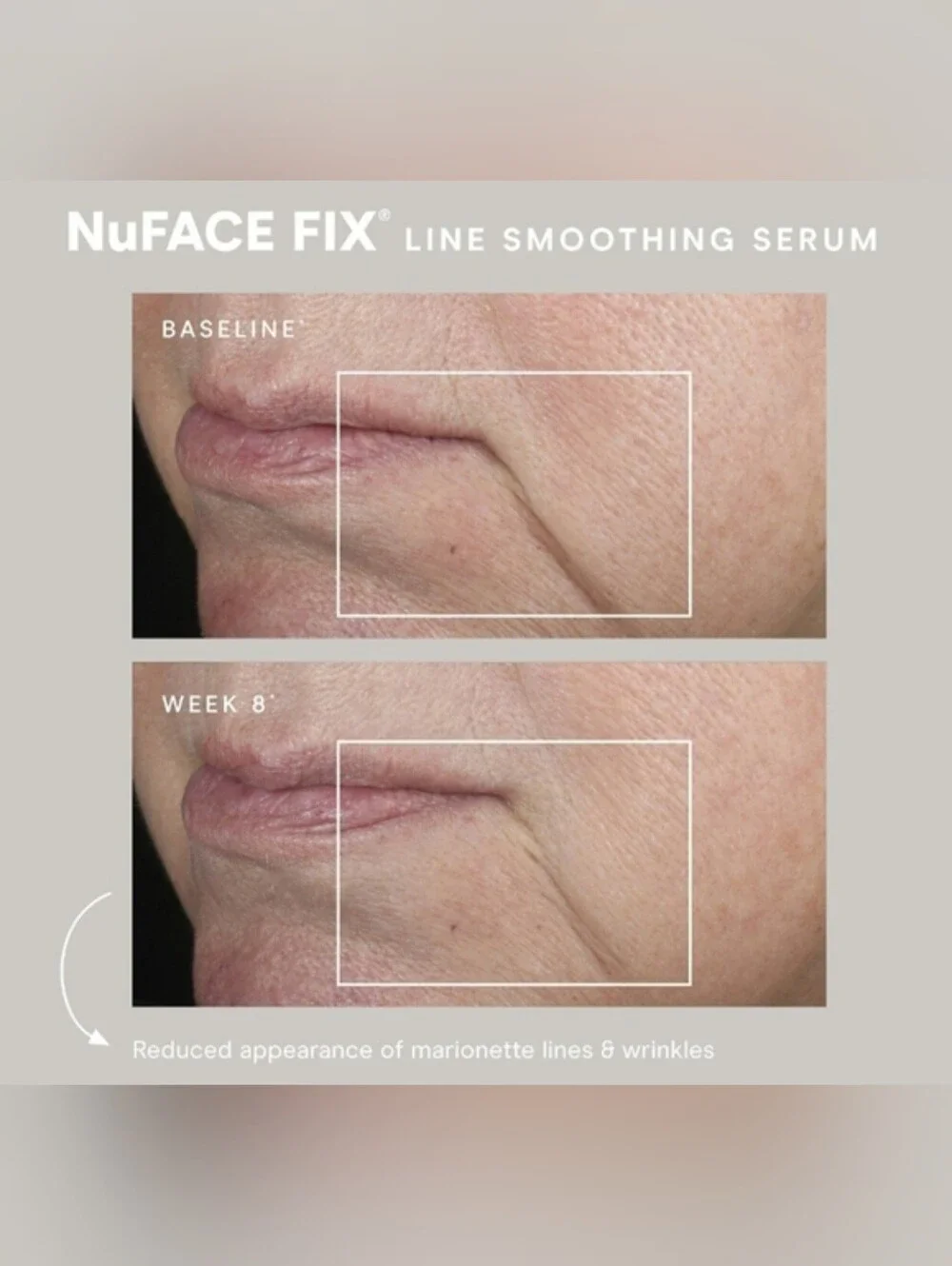 NuFace FIX Line Smoothing Serum - New In Box